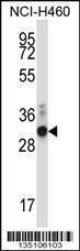 Anti-ZFPL1 (Center) Antibody