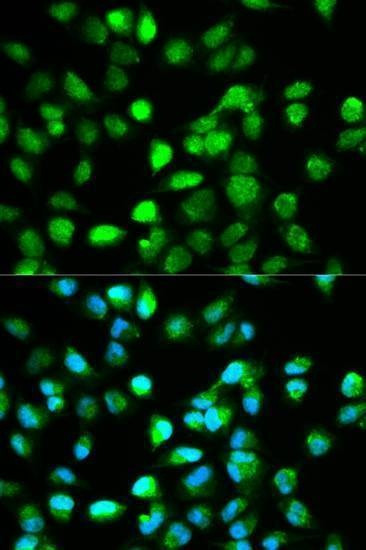 Anti-TCF4 Antibody
