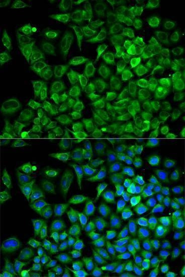 Anti-ALDOA Antibody
