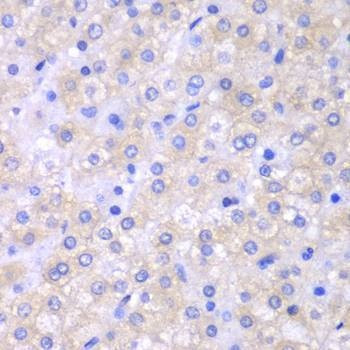 Anti-SH2D1A Antibody