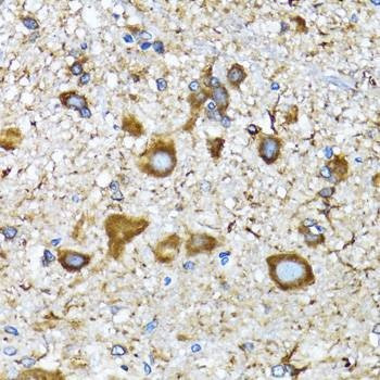 Anti-Mouse/Rat MAP1LC3A Antibody