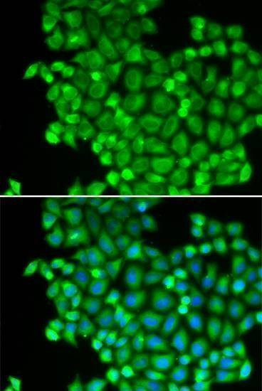 Anti-LDHA Antibody