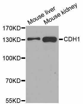 Anti-CDH1 Antibody