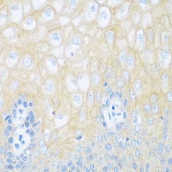 Anti-CDH1 Antibody