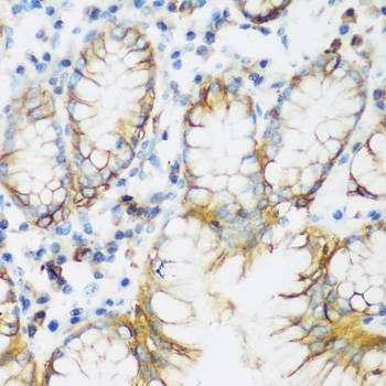 Anti-CDH1 Antibody