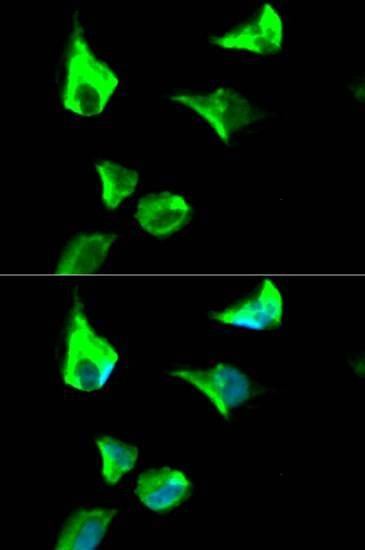 Anti-RRM1 Antibody