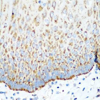 Anti-MT-CO2 Antibody