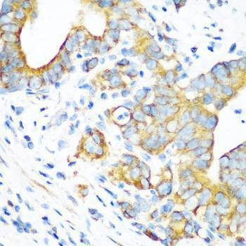 Anti-MT-CO2 Antibody