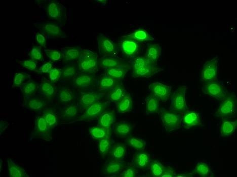 Anti-MAD1L1 Antibody
