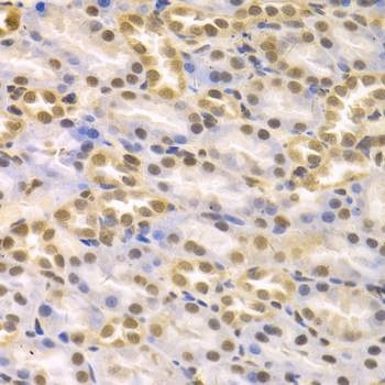 Anti-KDM1A Antibody