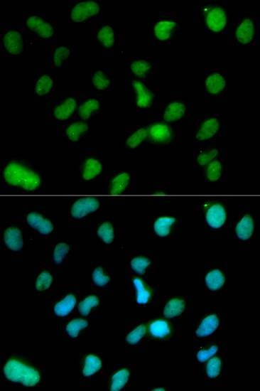 Anti-KDM1A Antibody