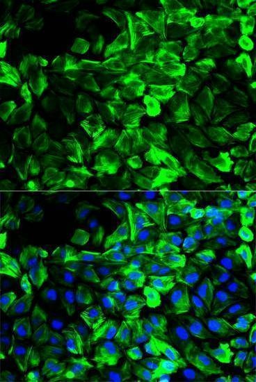 Anti-TPM1 Antibody