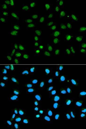 Anti-HNRNPA2B1 Antibody