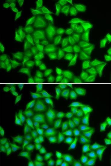 Anti-HNRNPA2B1 Antibody