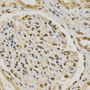 Anti-HNRNPA2B1 Antibody