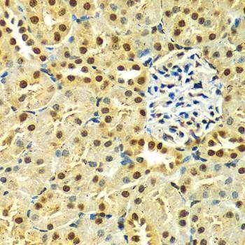 Anti-HNRNPA2B1 Antibody