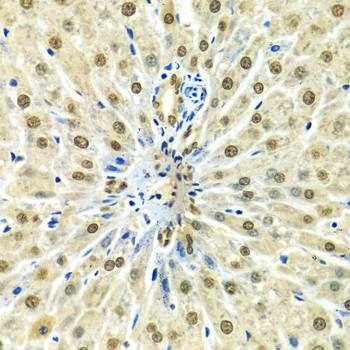 Anti-HNRNPA2B1 Antibody