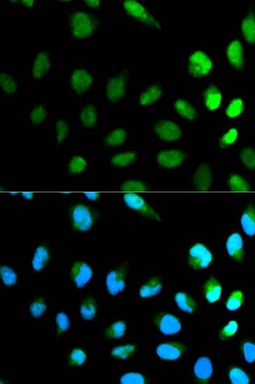 Anti-NEDD8 Antibody