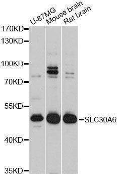 Anti-SLC30A6 Antibody