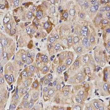 Anti-GAS2 Antibody
