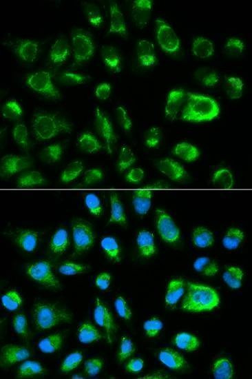Anti-GAS2 Antibody