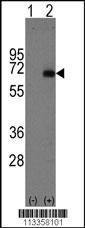Anti-AFP (Center) Antibody