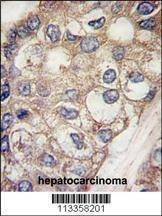 Anti-AFP (Center) Antibody