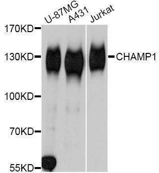 Anti-CHAMP1 Antibody