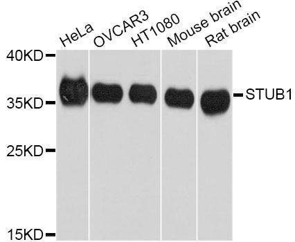 Anti-STUB1 Antibody