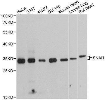Anti-SNAI1 Antibody