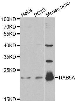 Anti-RAB5A Antibody