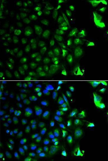 Anti-RAB5A Antibody