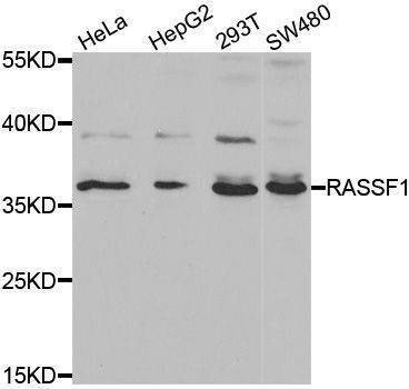 Anti-RASSF1 Antibody