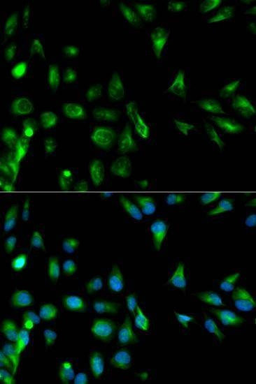 Anti-RASSF1 Antibody