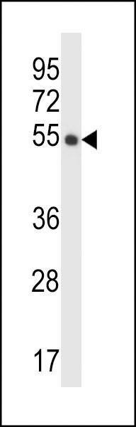 Anti-CRTRT1 (N-term) Antibody