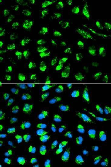 Anti-ECI1 Antibody