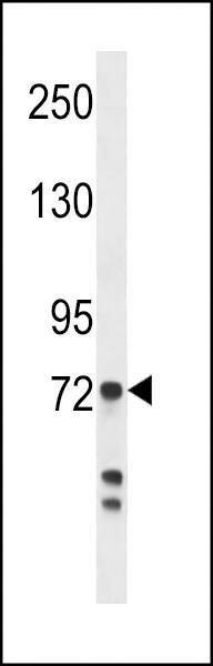 Anti-Myeloperoxidase (Center) Antibody