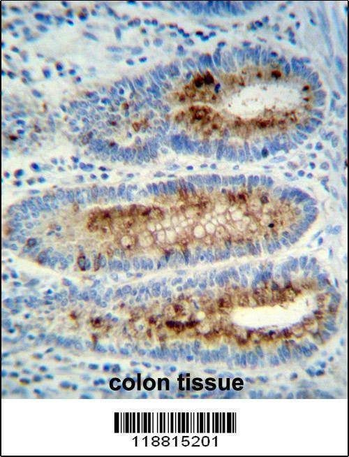 Anti-Myeloperoxidase (Center) Antibody