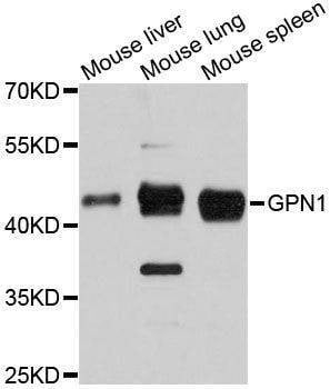 Anti-GPN1 Antibody