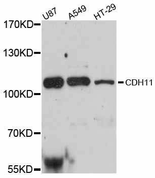 Anti-CDH11 Antibody