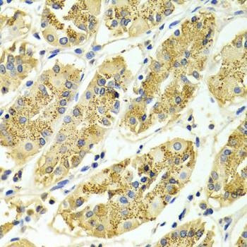 Anti-ARHGAP25 Antibody