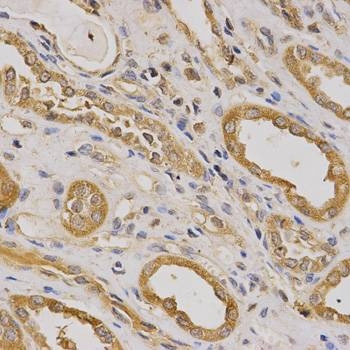 Anti-ARHGAP25 Antibody