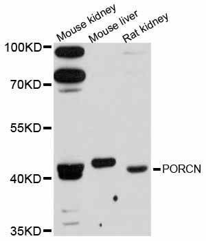 Anti-Mouse/Rat PORCN Antibody