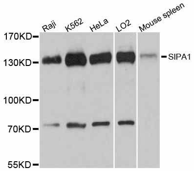 Anti-SIPA1 Antibody