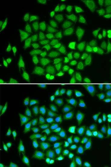 Anti-AKR7A2 Antibody