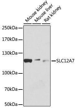 Anti-SLC12A7 Antibody