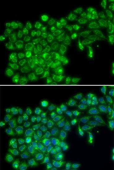 Anti-TNFSF13 Antibody
