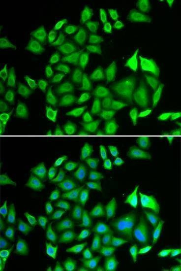 Anti-PSMA3 Antibody