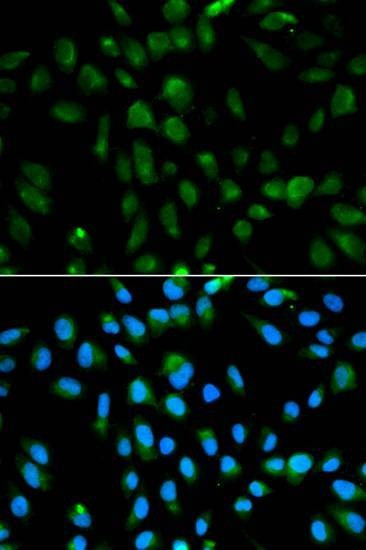 Anti-PSMA3 Antibody