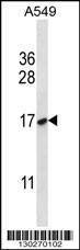 Anti-NFYB (N-term) Antibody
